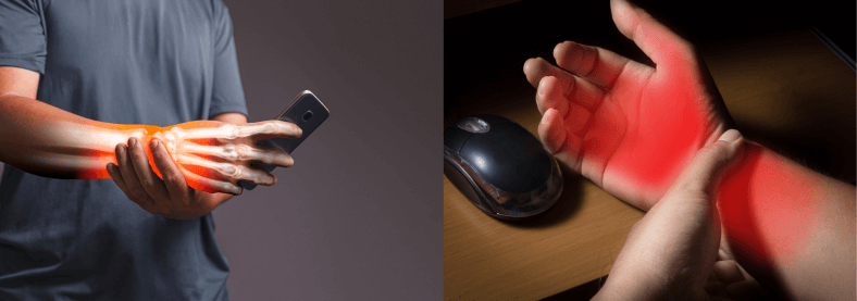 מהי תסמונת התעלה הקרפלית ולמה היא כל כך נפוצה?