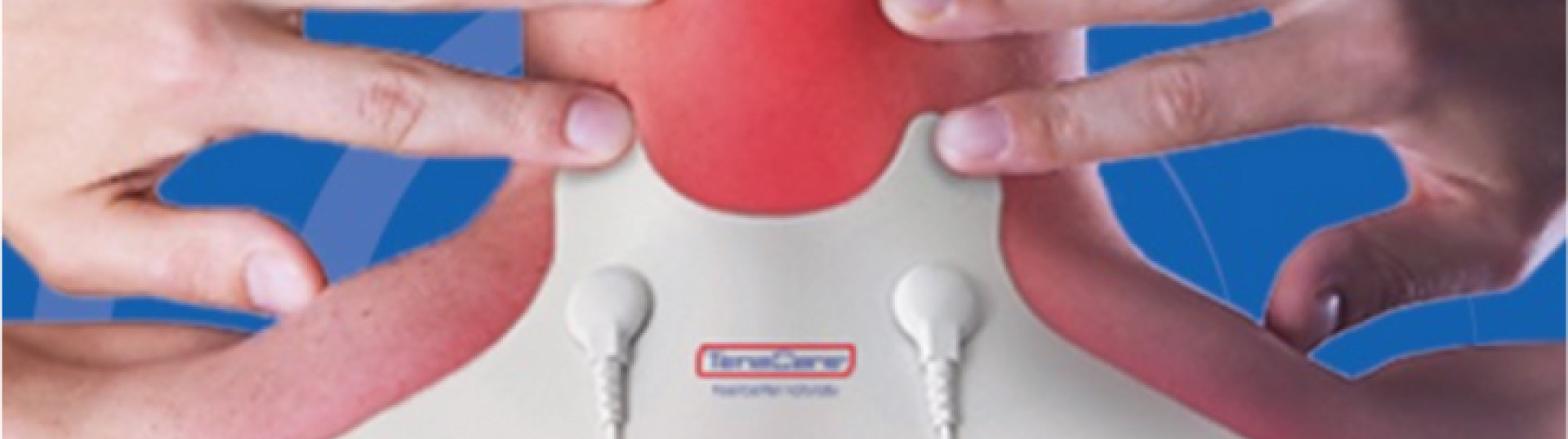 מה זה מכשיר TENS ואיך הוא עובד?