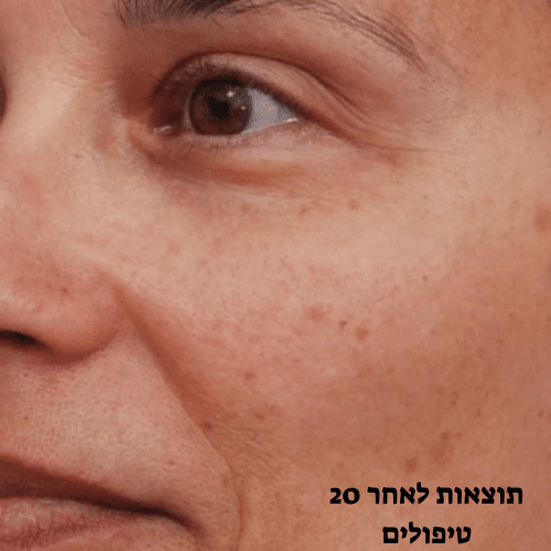 ניואה NEWA 13
